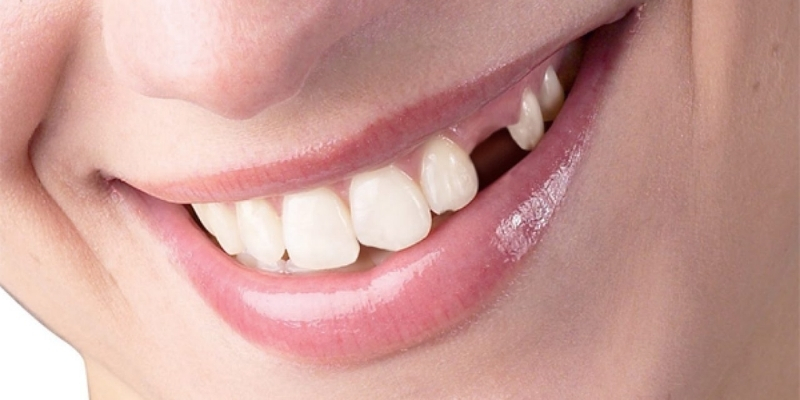 Cụ thể nằm mơ thấy rụng răng đánh số mấy?